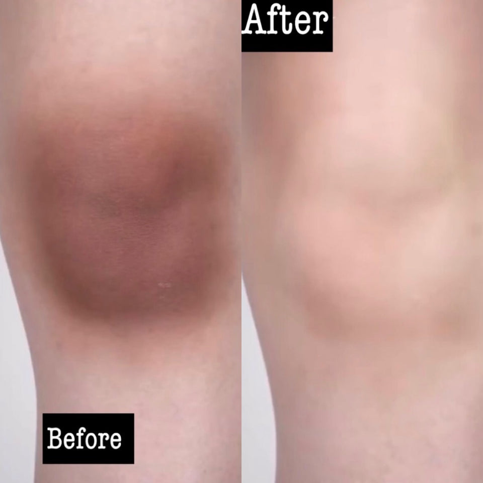 Turmeric & Kojic Acid Brightening Soap Bar