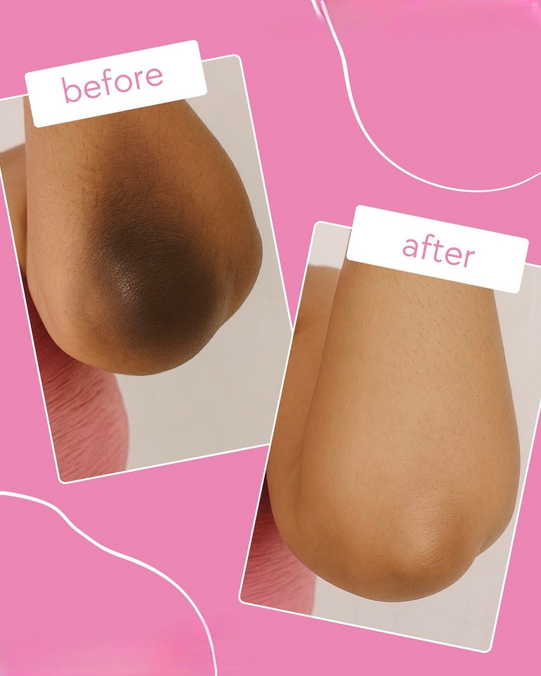 Turmeric & Kojic Acid Brightening Soap Bar