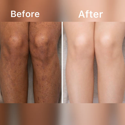SCRUBUCCINO Coffee Scrub🤎“Best For Acne, Stretch Marks & Dark Spots”