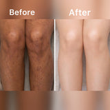 SCRUBUCCINO "Best For Acne, Stretch Marks & Dark Spots"