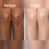 SCRUBUCCINO "Best For Acne, Stretch Marks & Dark Spots"